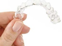 אינויזליין – יתרונות וחסרונות של השיטה ליישור שיניים שקוף